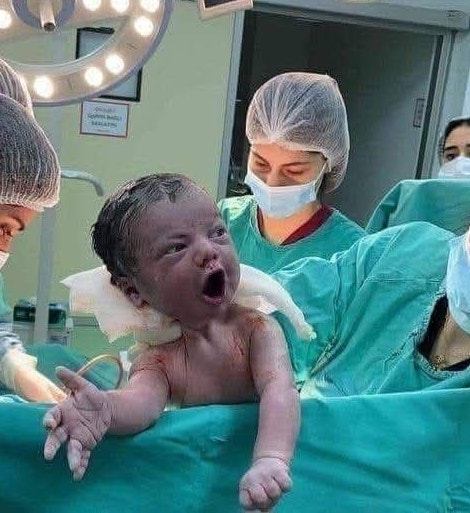 Novorodenec držaný lekármi v operačnej sále po pôrode, obklopený personálom v nemocnici.