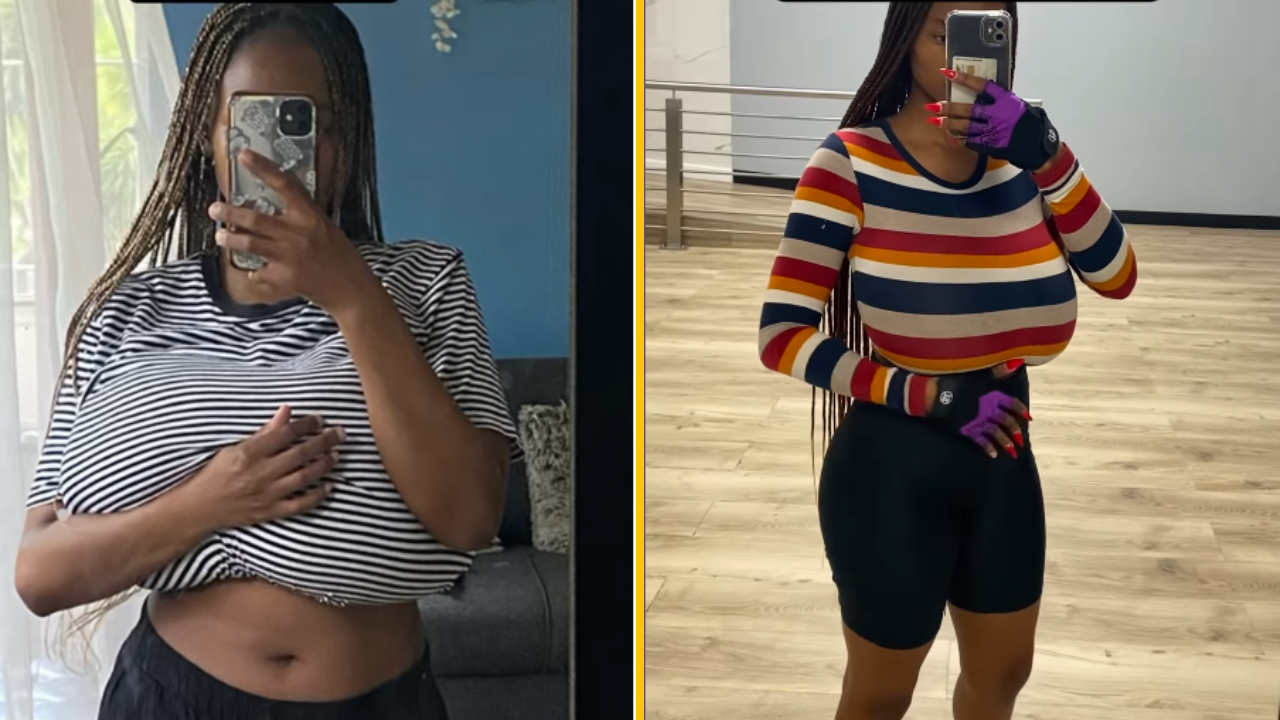 Prsia ženy narástli v priebehu pár mesiacov o 5 čísel kvôli zriedkavému stavu