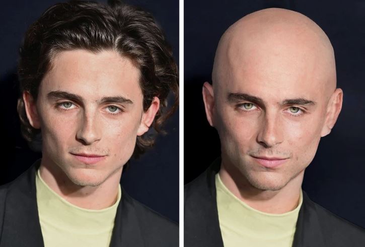 Osoba s vlasmi a bez vlasov vedľa seba, ukazujúca zmenu účesu alebo simuláciu plešatosti.