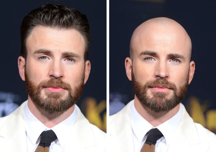 Dve fotografie muža: vľavo s vlasy, vpravo bez vlasov, v obleku na tmavom pozadí.