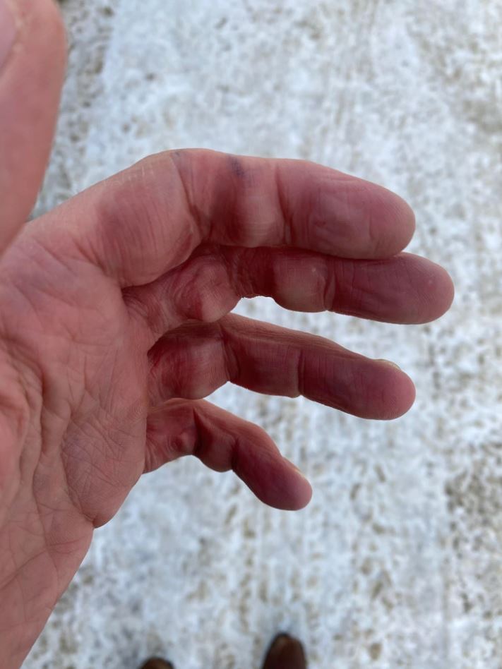 Ruka s modrastými prstami na mraze, biela znečistená zem na pozadí.