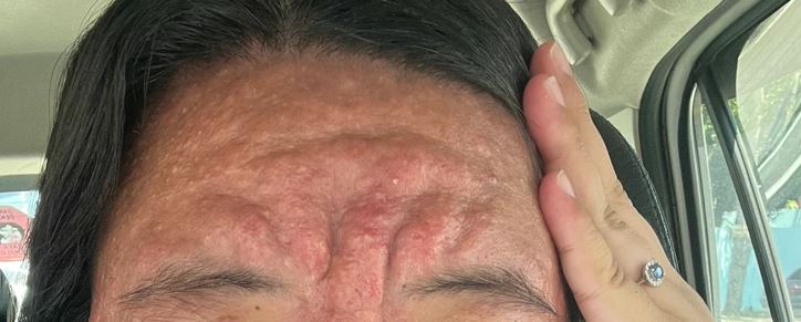 Osoba držiaca si hlavu v aute, zvrásnené čelo, jemné líčenie, denný svetlo vonku.