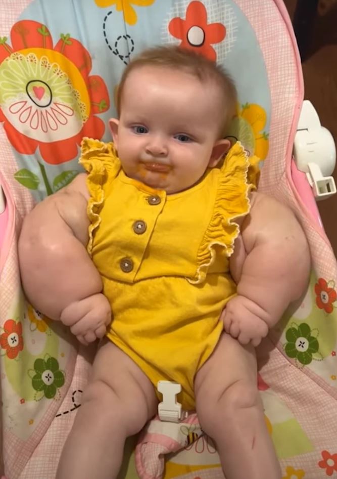 Dieťa v žltých šatách sedí na kvetovanom kresle, špinavé od jedla okolo úst.