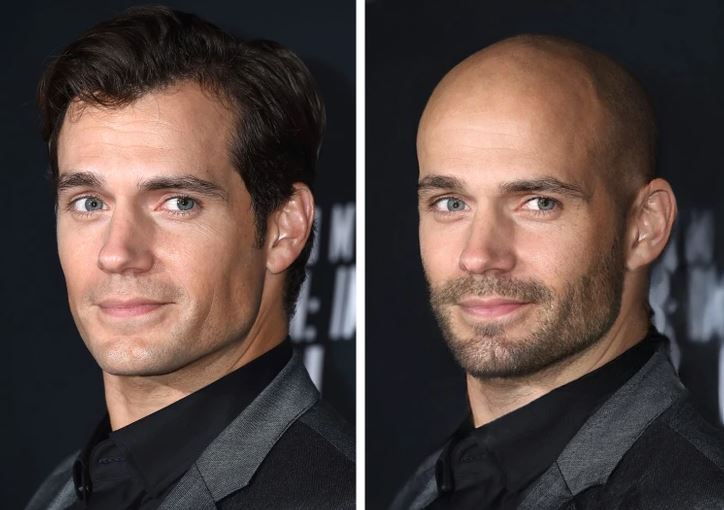 Dva portréty muža v obleku, jeden s vlasmi a druhý s holou hlavou na čiernom pozadí.