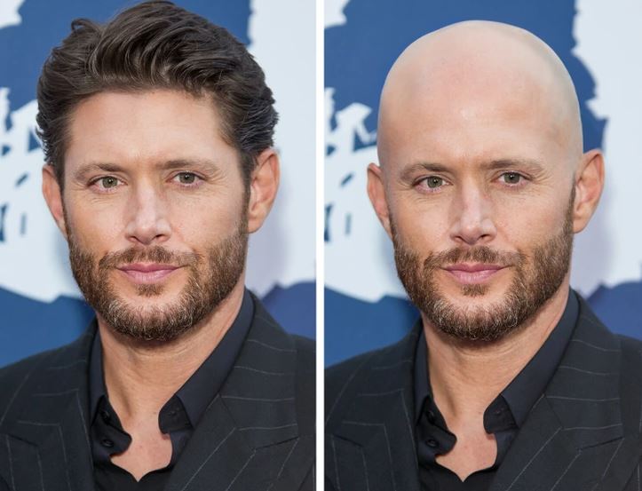 Porovnanie muža s vlasmi a bez vlasov, formálny outfit, modrý pozadie.