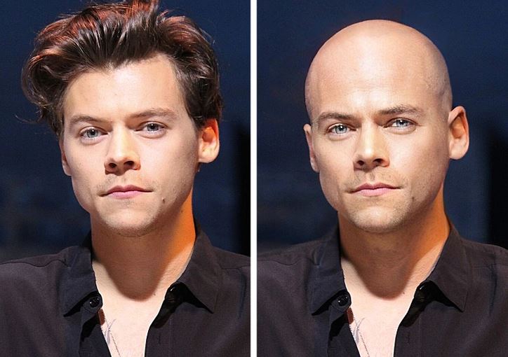 Porovnanie dvoch fotografií muža: naľavo s vlasmi, napravo bez vlasov.