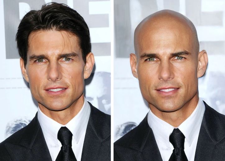 Dva portréty muža v obleku s rôznymi účesmi: s vlasmi a plešatý, usmievajúci sa, elegantný vzhľad.