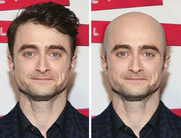 Dvojica portrétov muža: vlasy vľavo, holohlavý vpravo, na rovnakom pozadí, porovnanie účesov.