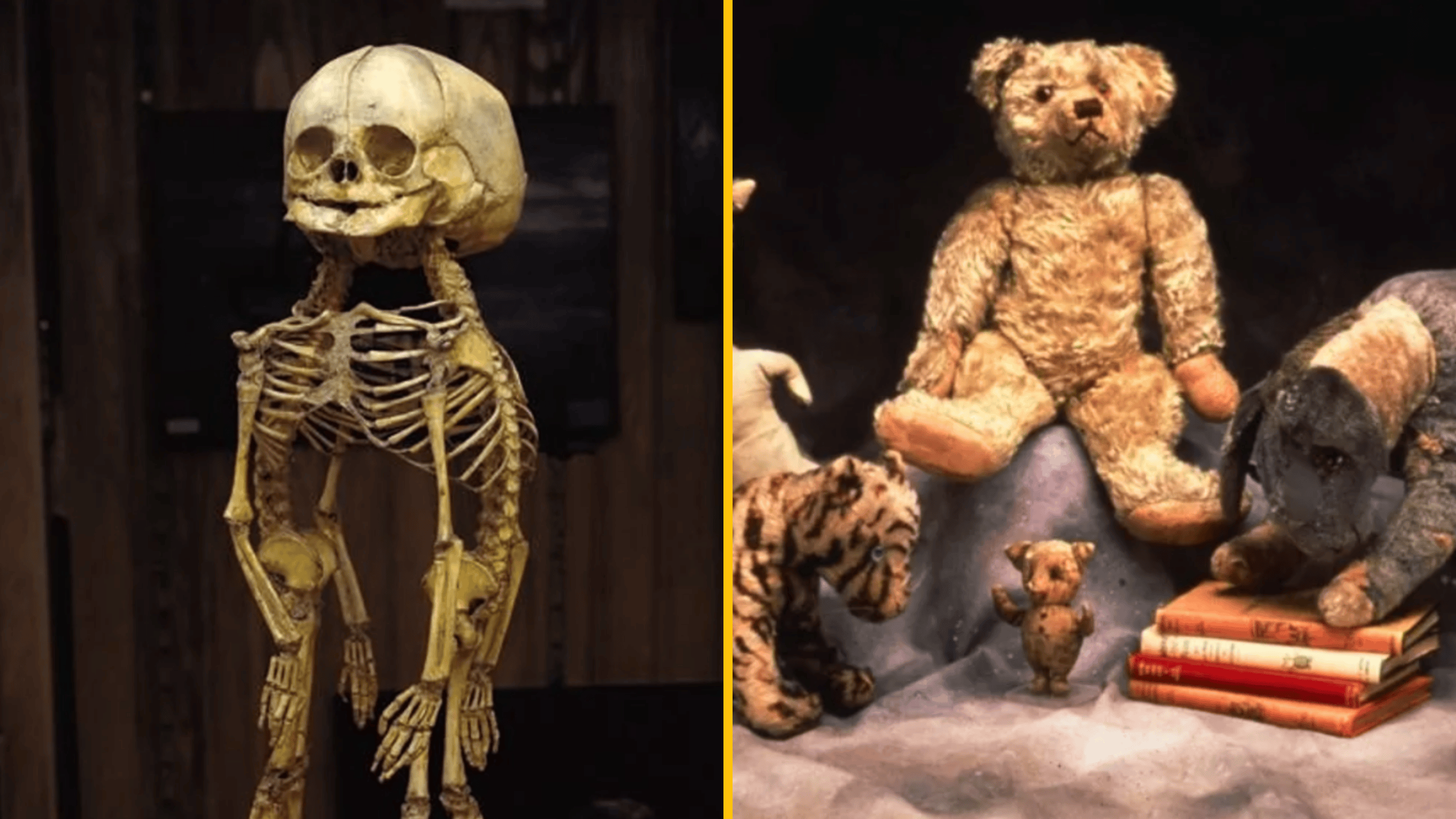 Kostra humanoida vedľa plyšových hračiek: mix reality a fantázie, kontrast medzi anatómii a detskou hrou.