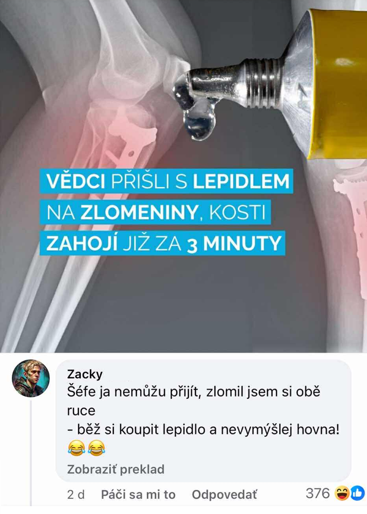 Vedecké lepidlo lieči zlomeniny za 3 minúty. Humorný komentár o rozbití rúk.