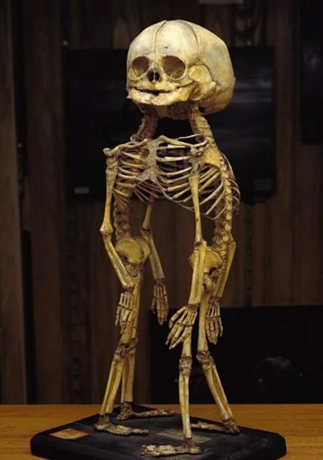 Kostrový exponát vystavený na stojane, historické umelecké dielo v múzeu.