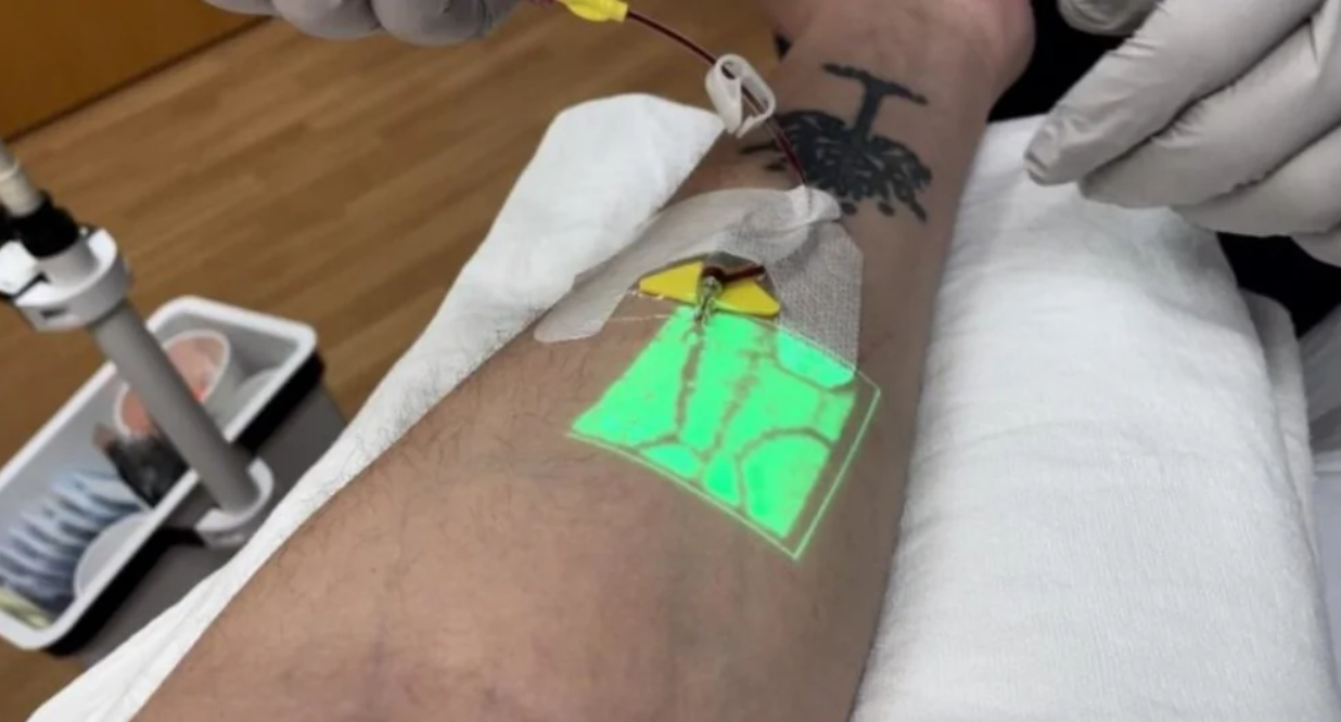 Zdravotnícke zariadenie používa projektor na zobrazenie žíl pacienta pre presné zavedenie ihly.