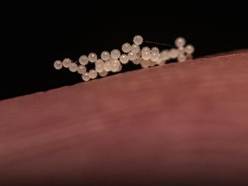 Vrstva drobných, bielych vajíčok hmyzu na ružovom povrchu, detailný záber na čiernom pozadí.