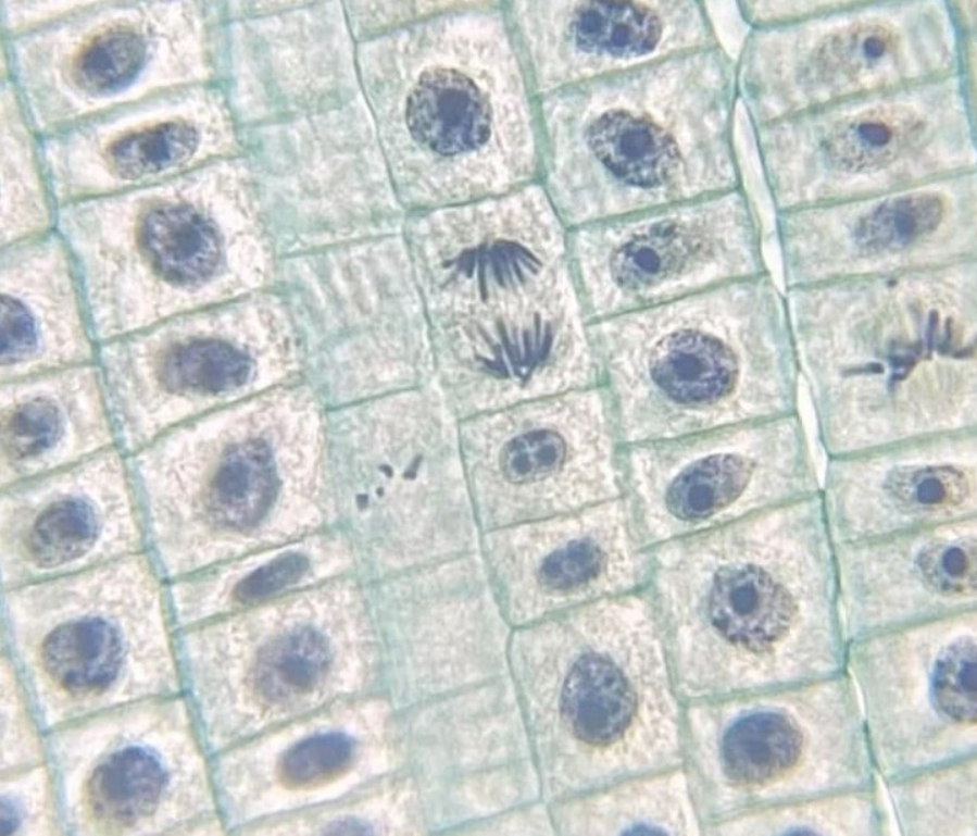 Mikroskopický pohľad na rastlinné bunky počas mitózy, ukazujúci delenie jadra a chromozómov.