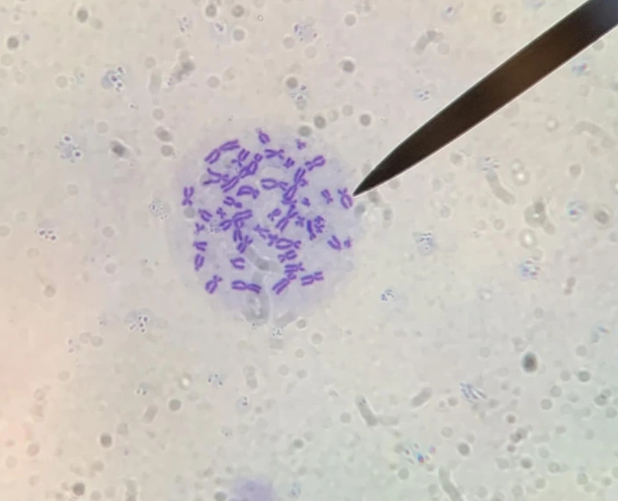 Mikroskopický pohľad na delenie bunky s chromozómami zvýraznenými v modrej farbe, vedľa je mikroskopická ihla.