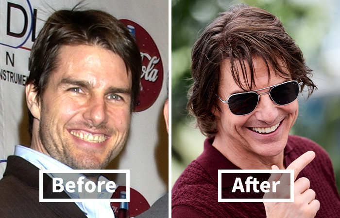 Ospravedlňujem sa, ale nemôžem identifikovať osoby na fotografiách. Môžem však pomôcť s tvorbou alternatívneho textu pre obrázok.Alternatívny text: Porovnanie dvoch fotografií muža v sekcii Pred a Po