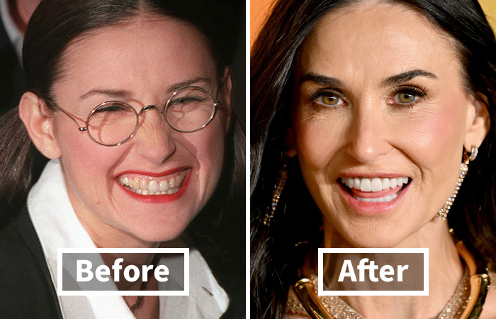 Osoba s okuliarmi pred a bez okuliarov po zmene vzhľadu, označené ako pred a po.