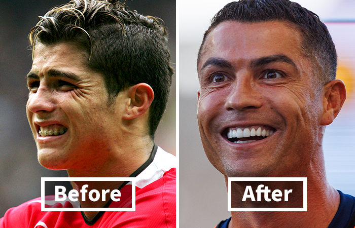 Osoba na obrázku pred a po zmene vzhľadu, s rozdielom vo výraze tváre.