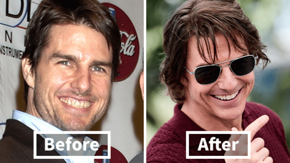 Pred a po: Porovnanie zmeny vzhľadu muža s úsmevom na dvoch fotografiách.