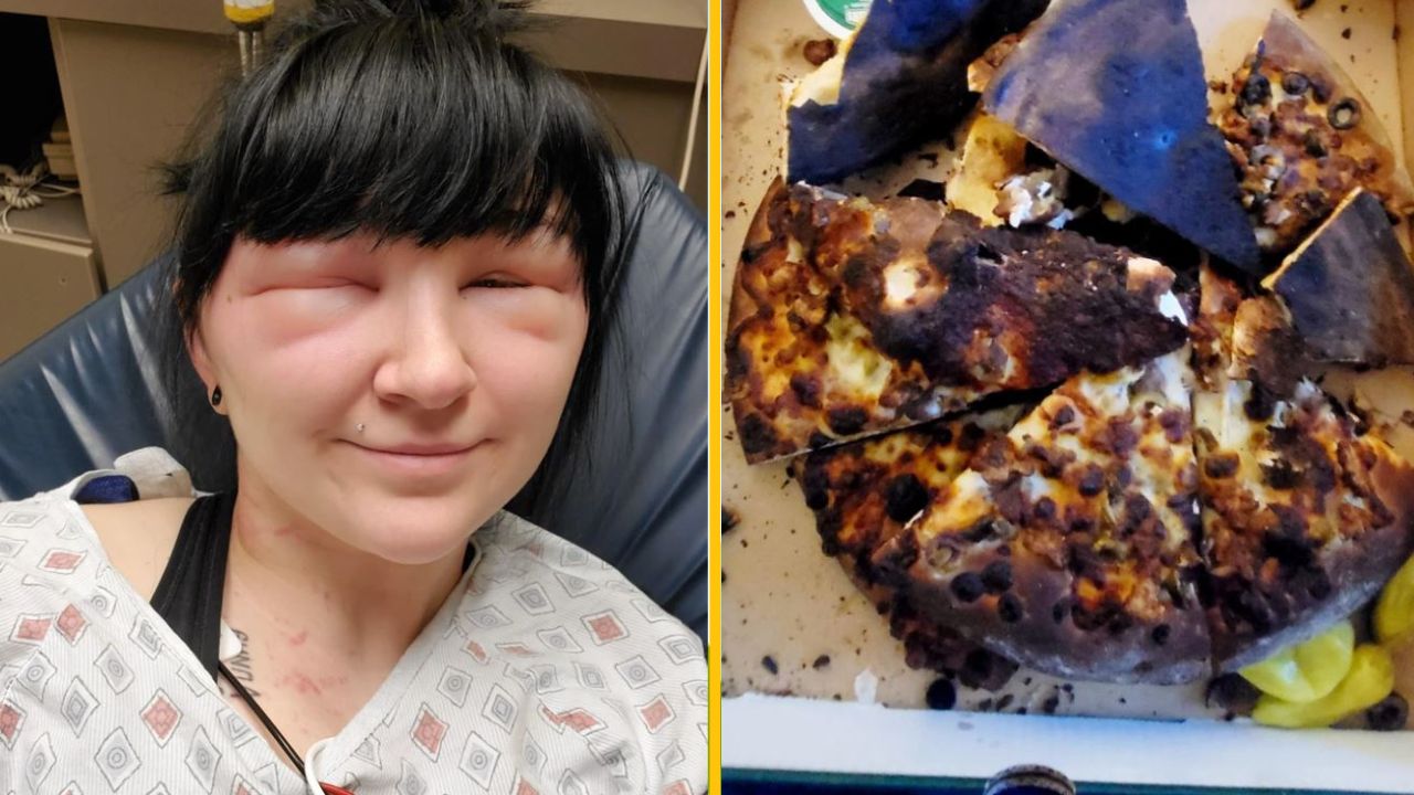 Osoba v nemocničnom prostredí s opuchnutými očami vedľa prepálenej pizze v krabici.