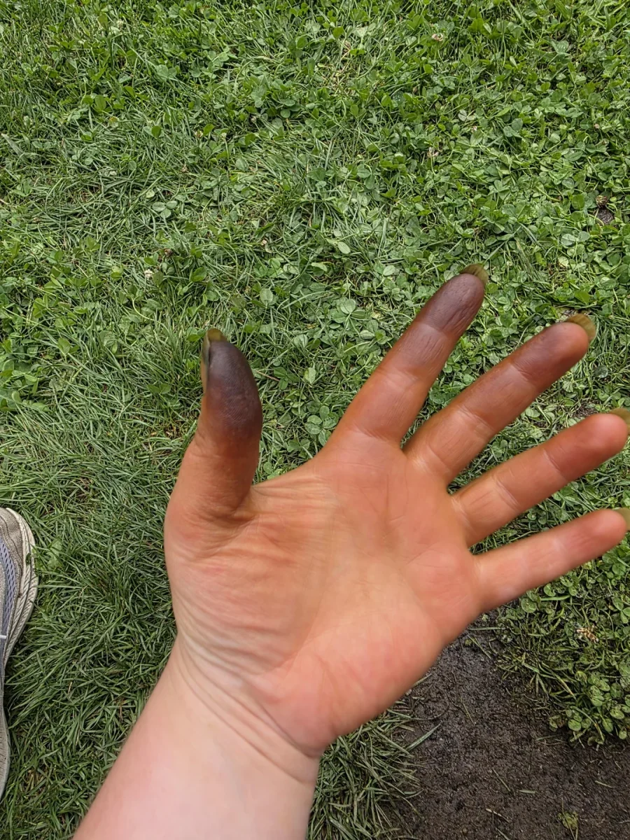 Ruka s hnedými škvrnami na trávniku, ukazujúca prácu v záhrade alebo práve dokončené záhradkárske aktivity.