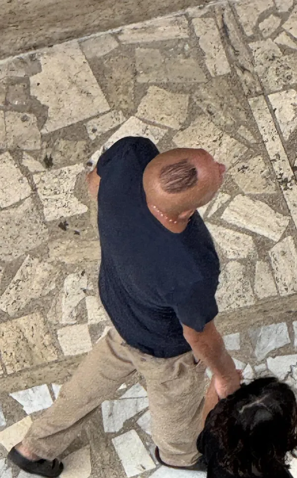 Bald muž s tmavým pruhom vlasov na hlave kráča po vzorovanej dlažbe vedľa ženy.