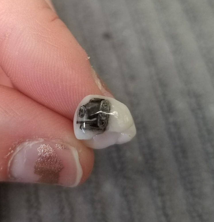 Keramická zubná korunka s potlačou auta držiacimi prstami na sivej podložke.