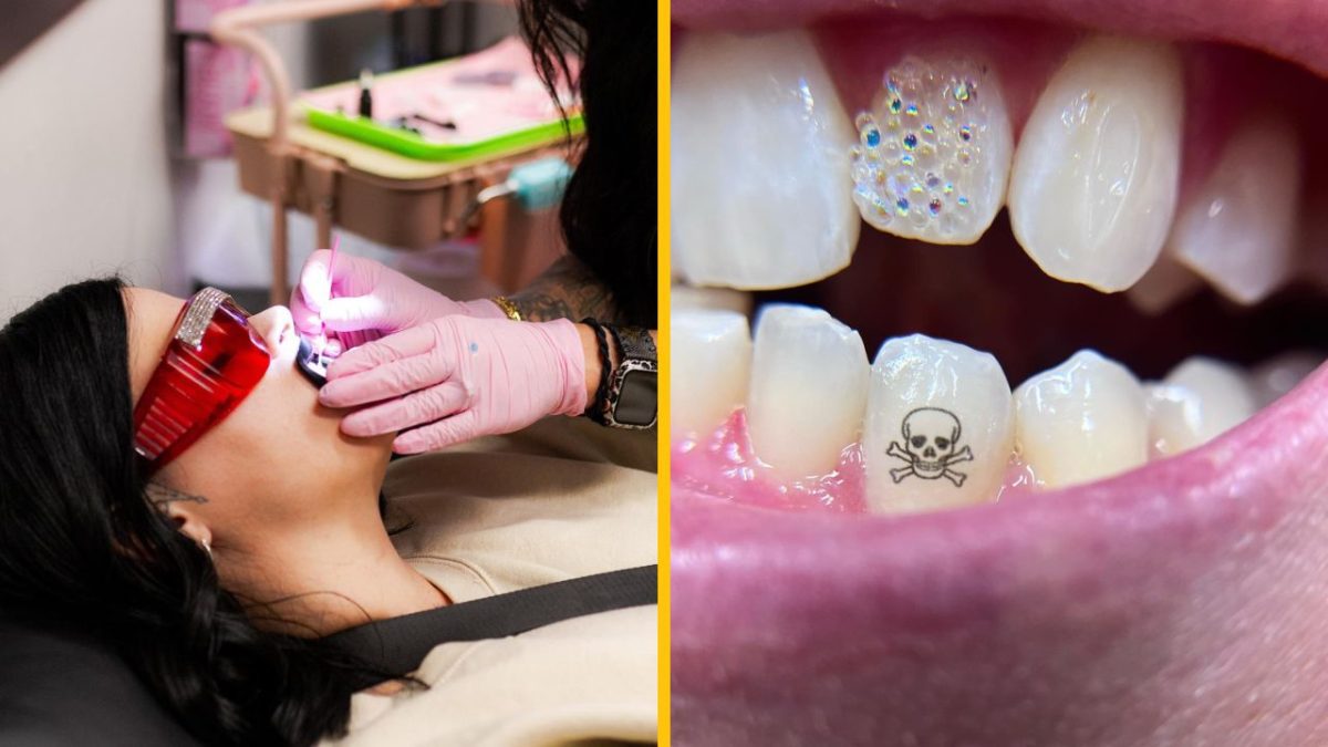 Osoba s ochrannými okuliarmi dostáva dentálnu starostlivosť; detail zubu so symbolom lebky.