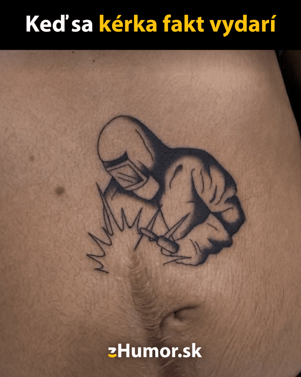 Tetovanie zvárača na koži so zjazvou, vytvárajúce ilúziu zvárania jazvy.