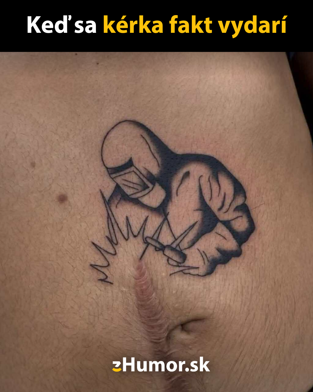 Tetovanie zvárača na koži so zjazvou, vytvárajúce ilúziu zvárania jazvy.