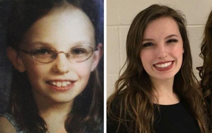 Dva portréty ženy, jeden z detstva v okuliaroch a druhý z dospelosti s úsmevom.