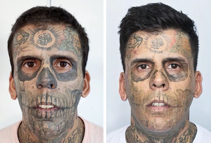 Osoba s tetovaním na tvári pred a po úprave, porovnanie zmien vzhľadu.