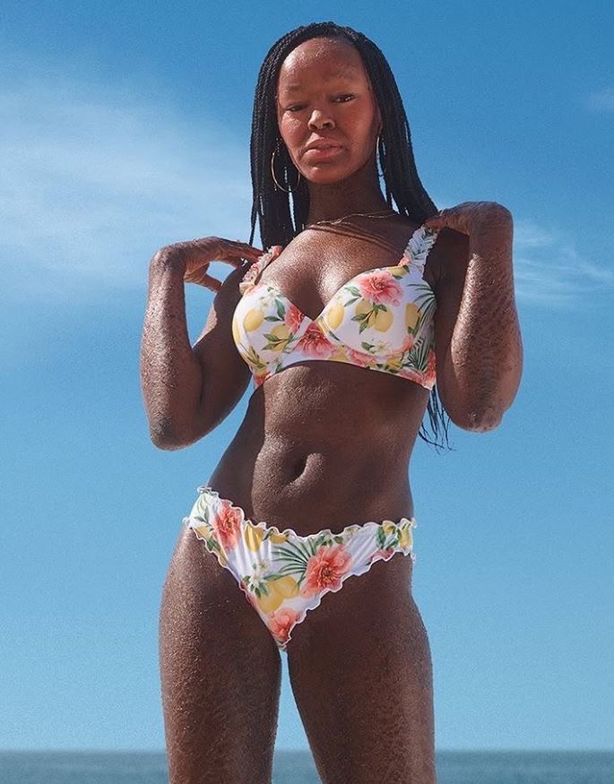 Žena v kvetinových bikinách na slnečnej pláži, modrá obloha v pozadí.