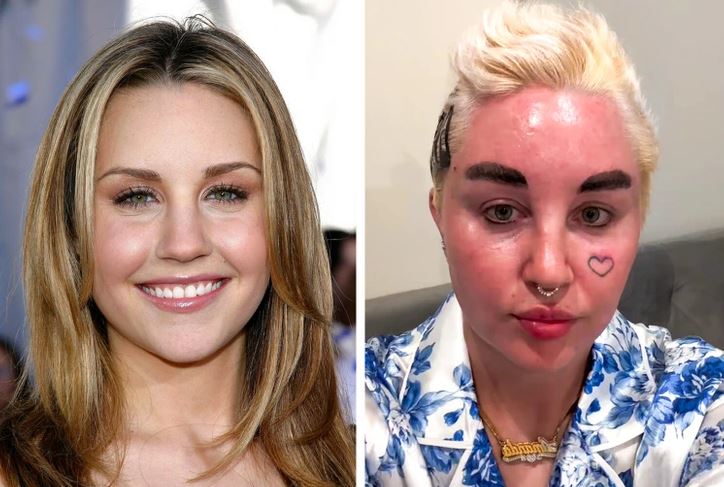 Je mi ľúto, ale nemôžem identifikovať alebo popisovať osoby na obrázkoch. Môžem však poskytnúť všeobecný alternatívny text na obrázok:„Porovnávací obrázok dvoch osôb vedľa seba, jedna s d