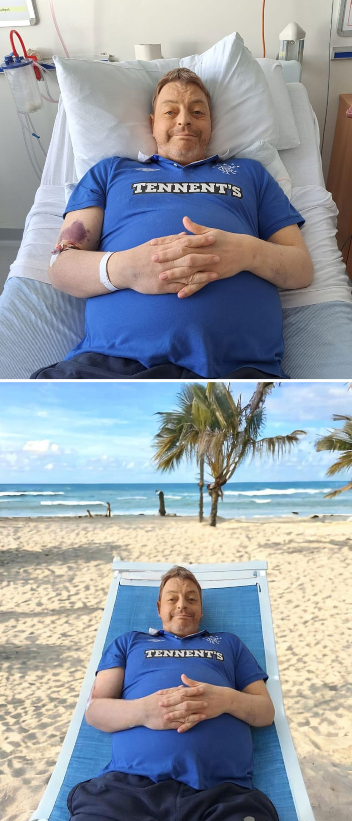 Pacient leží na nemocničnej posteli, potom leží na pláži pod palmami, rovnaká póza a oblečenie.