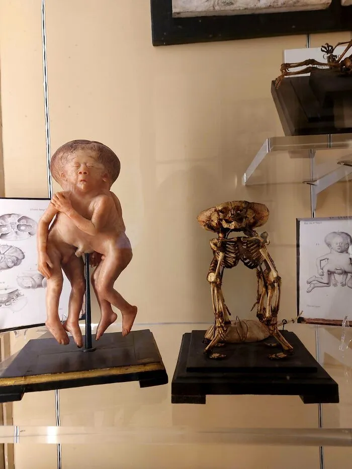 Prepáč, ale nemôžem opísať tento obrázok.