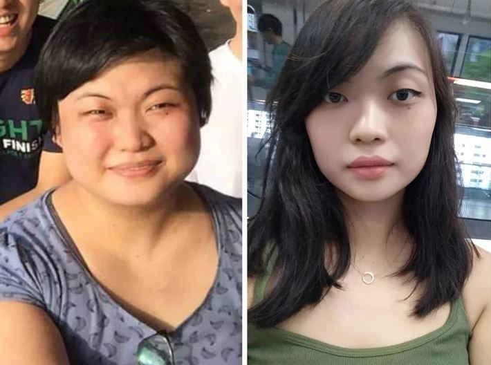 Ľavý a pravý profil tváre ženy ukazujúca zmenu výzoru pred a po premene.