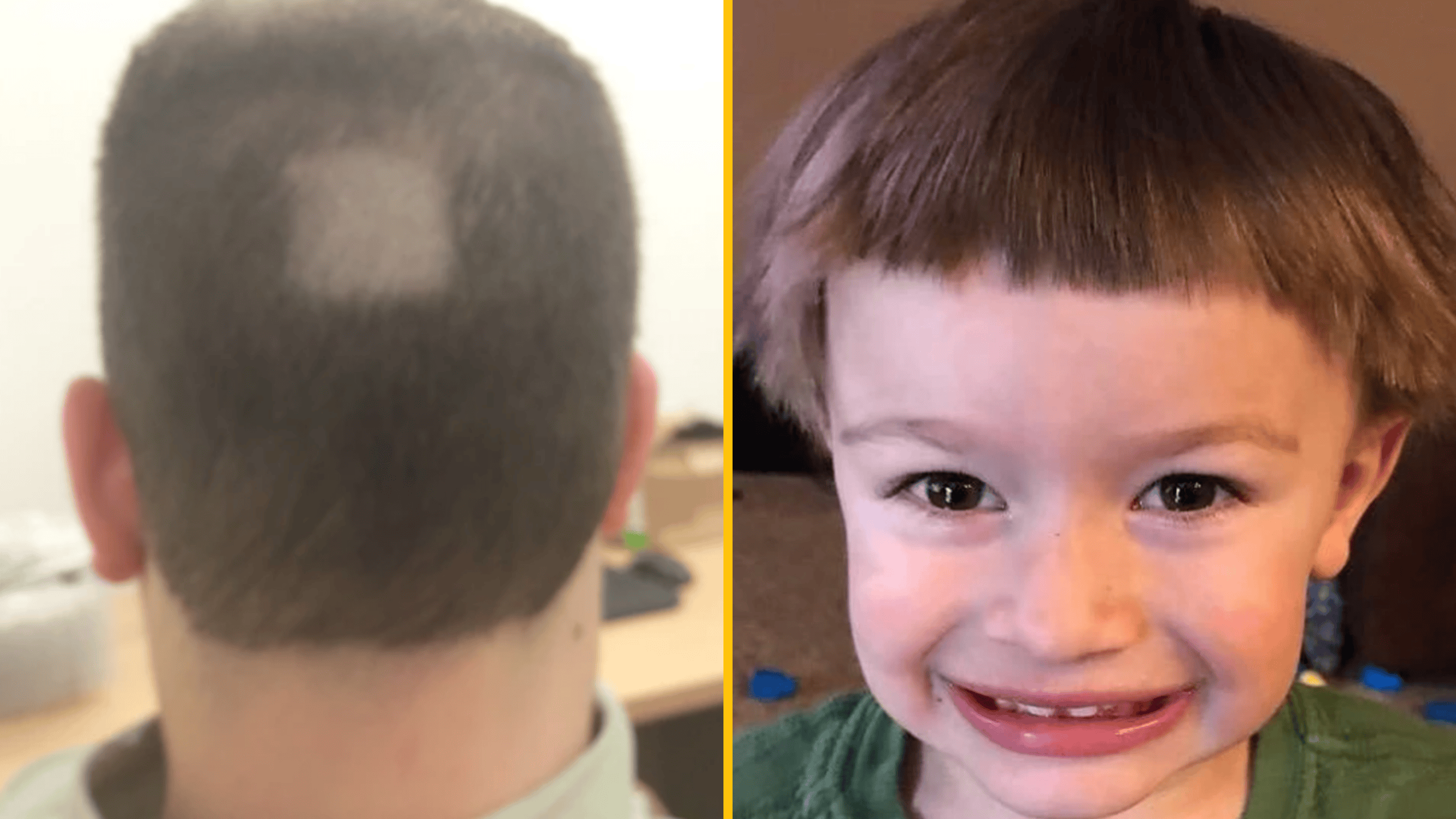 Muž s cestou v strihu na zadnej časti hlavy a chlapec s vlastnoručne ostrihanými vlasmi.