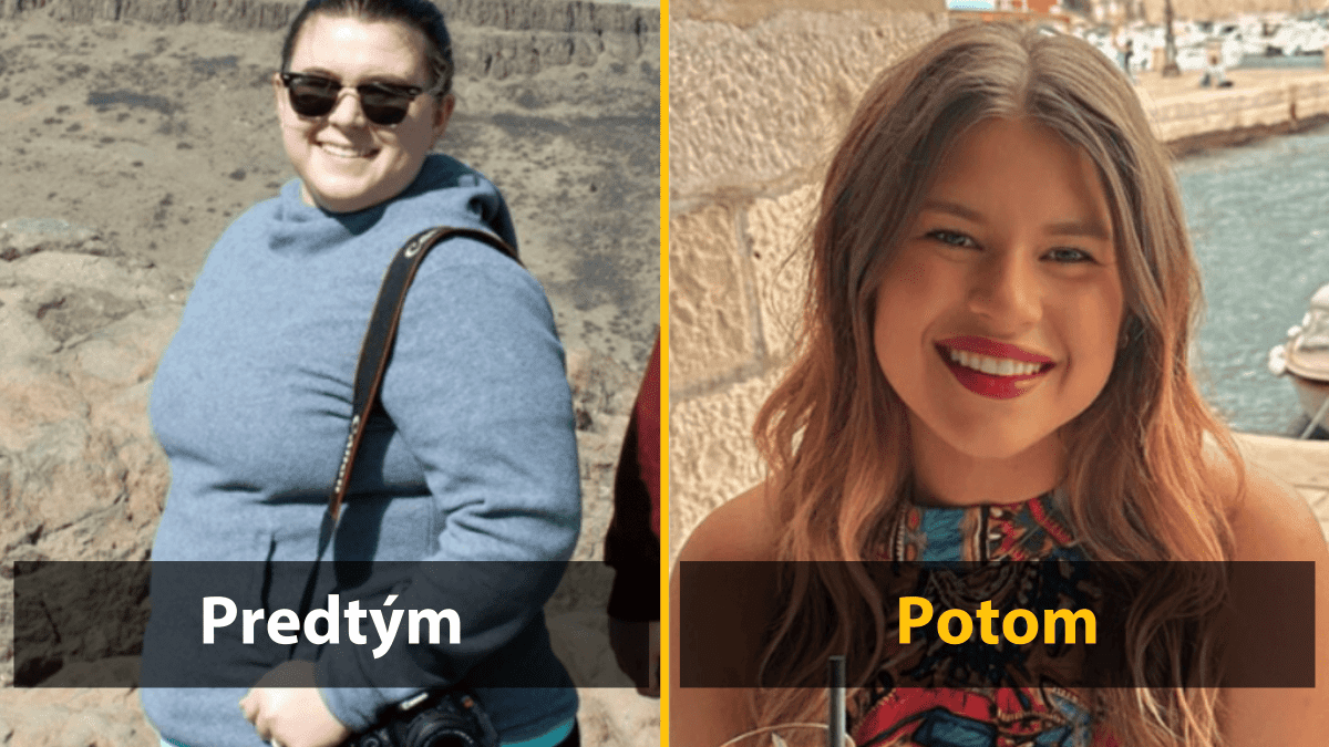 Osoba pred a po zmene výzoru, úsmevné porovnanie v exteriéri, úspešná premena.