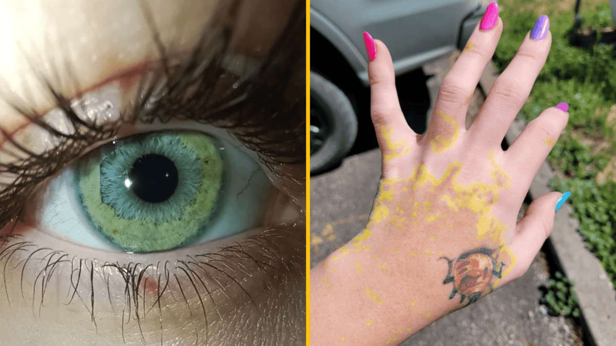 Zelené oko zblízka; ruka s farebnými nechtami a žltými škvrnami.