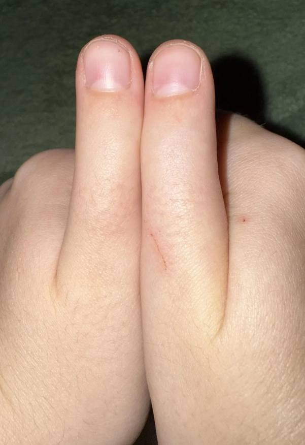 Ruky s dotýkajúcimi sa ukazovákmi, jemným odtieňom pleti a krátkymi nechtami na tmavom pozadí.