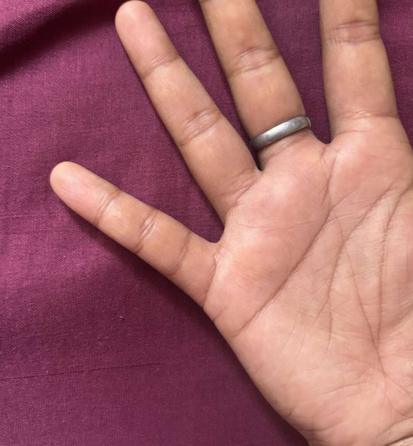 Ruka s prsteňom na fialovom pozadí, detailné zobrazenie otvorenej dlane a trapézového prsteňa.