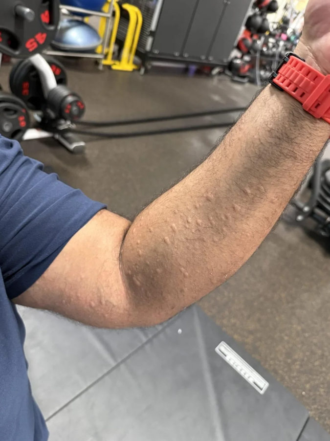 Osoba s červenými hodinkami zdvíha ruku v posilňovni, v pozadí sú činky a fitness vybavenie.