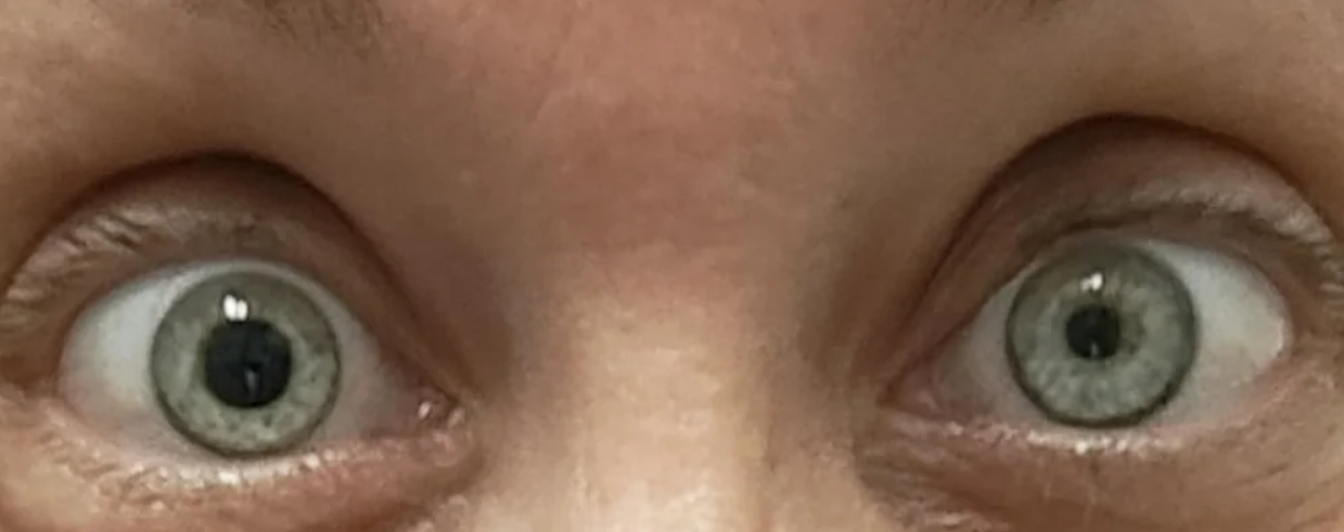 Oči s rozšírenými zrenicami plné údivu alebo prekvapenia.