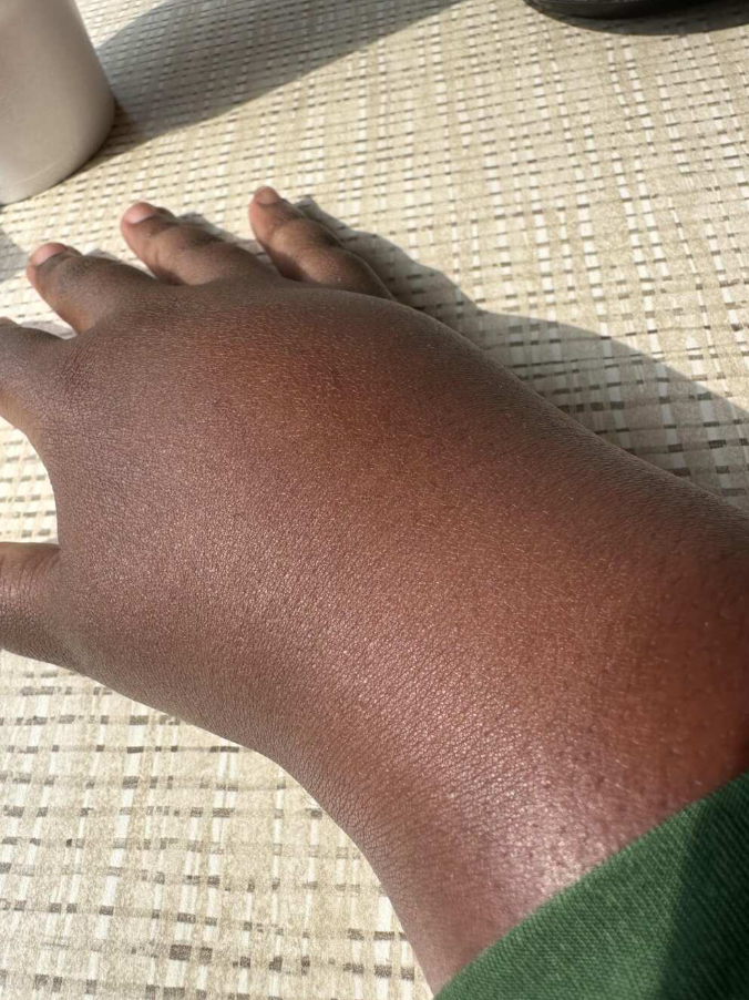 Ruka na svetločervenom stole v slnečnom svetle, detail pokožky.