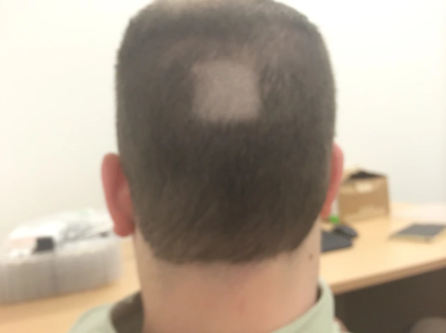 Muž s krátkymi vlasmi v kancelárii má na temene prestrihnuté miesto pre smiech alebo nedopatrenie.