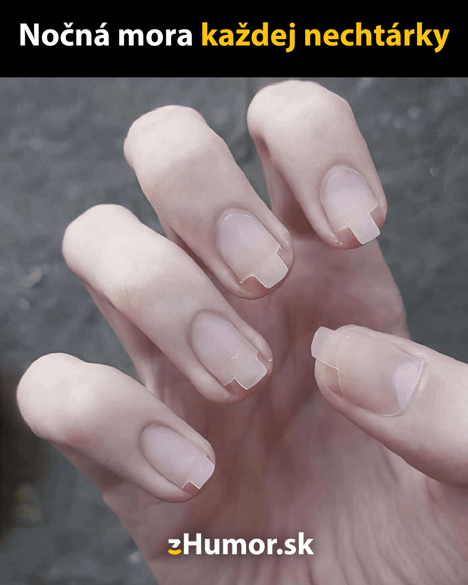 Nechty so štvorcovými zlomeninami, detailný pohľad na ruky, nočná mora nechtárky, zblízka.