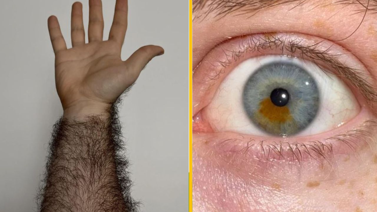 20 ľudí, ktorí dokazujú, že práve to, čo nás odlišuje, nás robí krásnymi