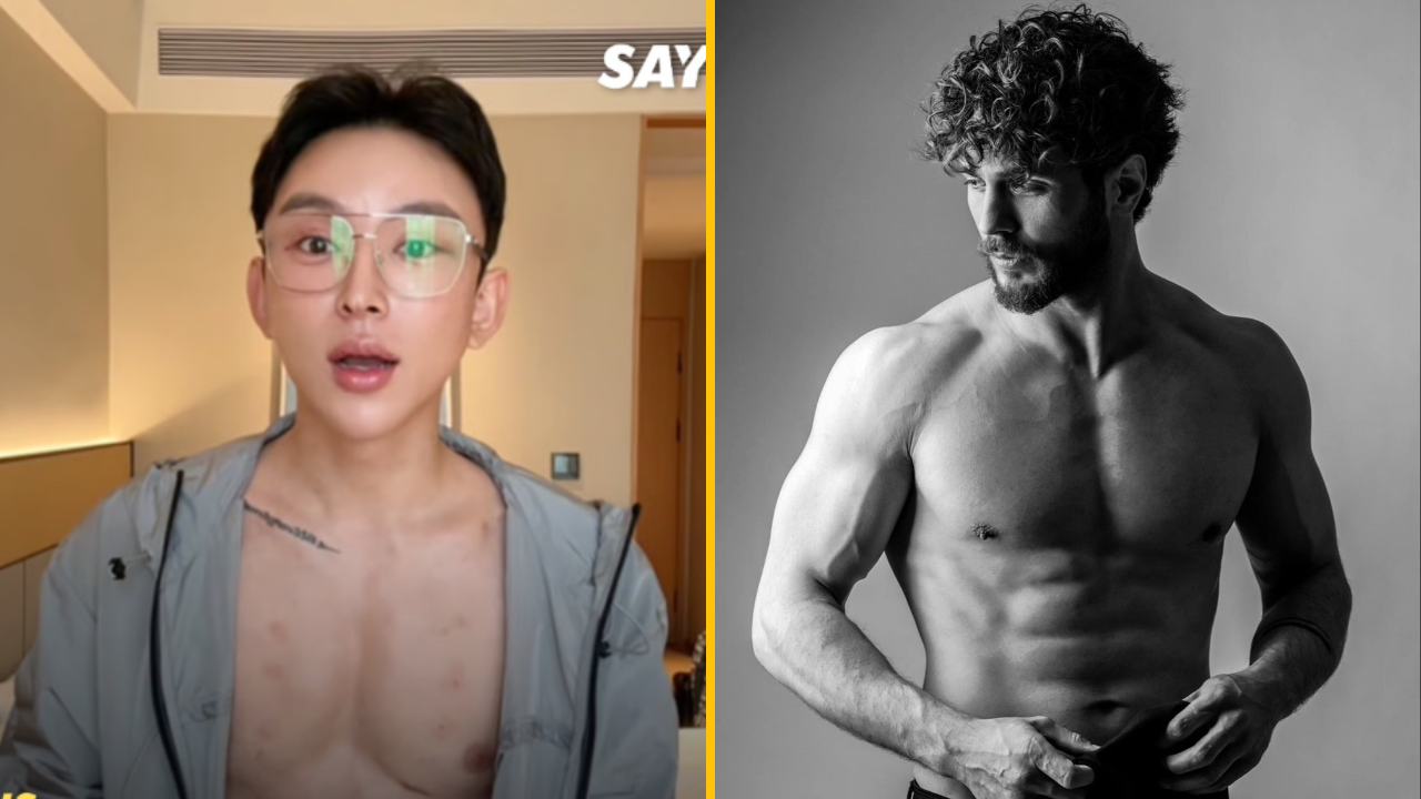 Muž dal za hyalurónové injekcie na vyplnenie brušných svalov 480 000 €