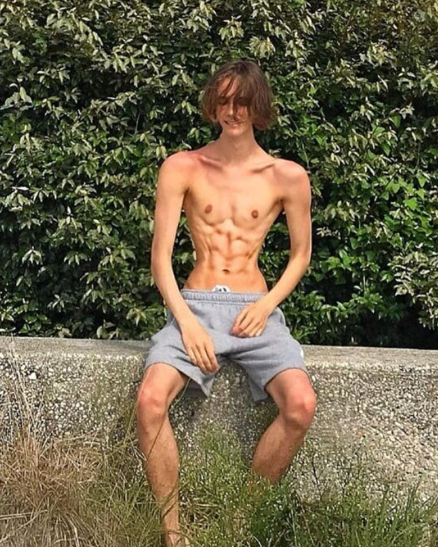 Osoba sediaca vonku na múriku s bujnou zeleňou v pozadí, oblečená v šortkách.